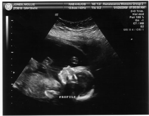 baby3.jpg