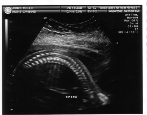 baby6.jpg